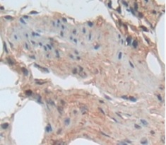 Immunohistochemistry (Formalin/PFA-fixed paraffin-embedded sections) - Anti-ADAMTS5 antibody (AB231595)