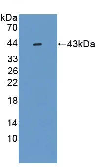 Western blot - Anti-ADAMTS5 antibody (AB231595)