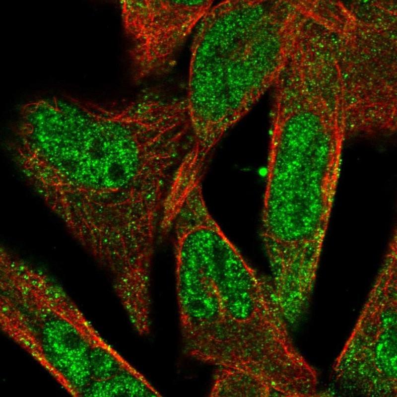 Immunocytochemistry/ Immunofluorescence - Anti-ADAMTS5 antibody (AB246975), expandable thumbnail