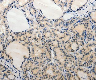 Immunohistochemistry (Formalin/PFA-fixed paraffin-embedded sections) - Anti-ADAMTS6 antibody (AB198725)