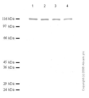 Western blot - Anti-ADAMTS6 antibody (AB50647)