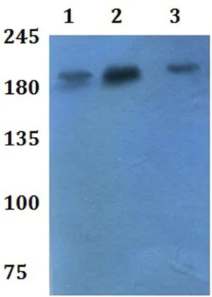 Western blot - Anti-ADAMTS7 antibody (AB201083)
