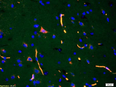 Immunohistochemistry (Formalin/PFA-fixed paraffin-embedded sections) - Anti-ADAMTS7 antibody (AB203027)