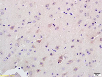 Immunohistochemistry (Formalin/PFA-fixed paraffin-embedded sections) - Anti-ADAMTS7 antibody (AB203027)