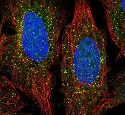 Immunocytochemistry/ Immunofluorescence - Anti-ADAMTS7 antibody (AB222383)