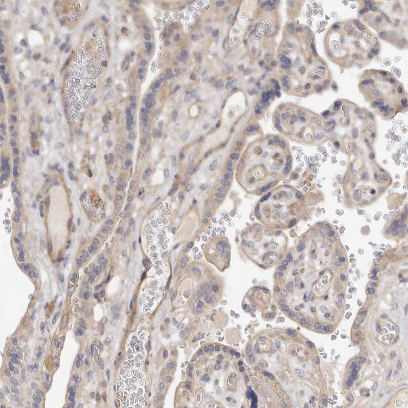 Immunohistochemistry (Formalin/PFA-fixed paraffin-embedded sections) - Anti-ADAMTS9 antibody (AB224132), expandable thumbnail