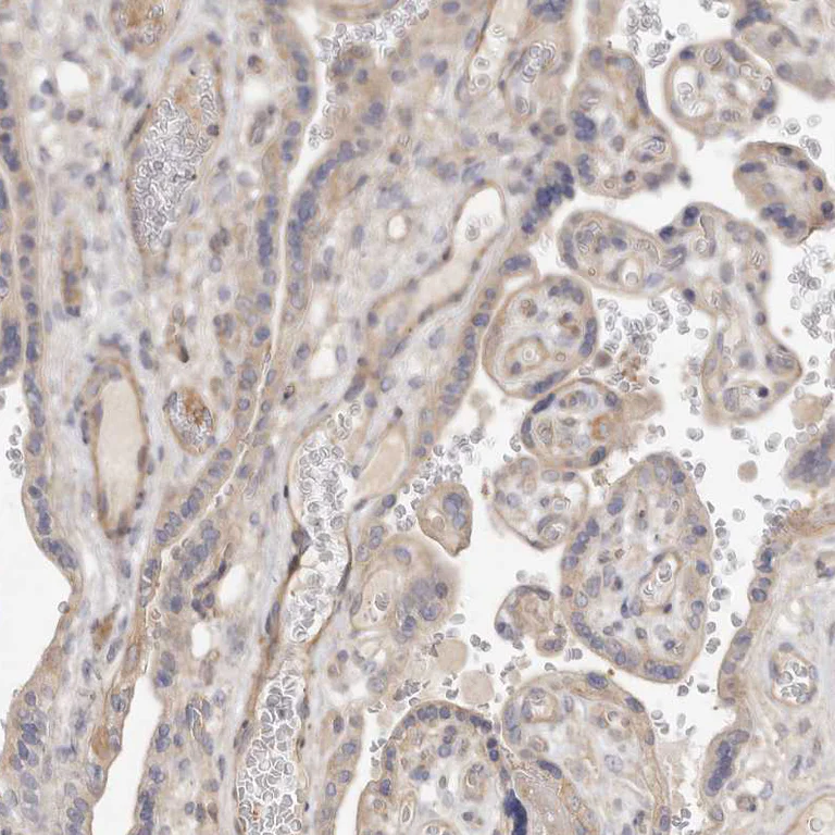 Immunohistochemistry (Formalin/PFA-fixed paraffin-embedded sections) - Anti-ADAMTS9 antibody (AB224132)