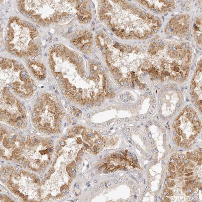 Immunohistochemistry (Formalin/PFA-fixed paraffin-embedded sections) - Anti-ADAMTS9 antibody (AB224132), expandable thumbnail