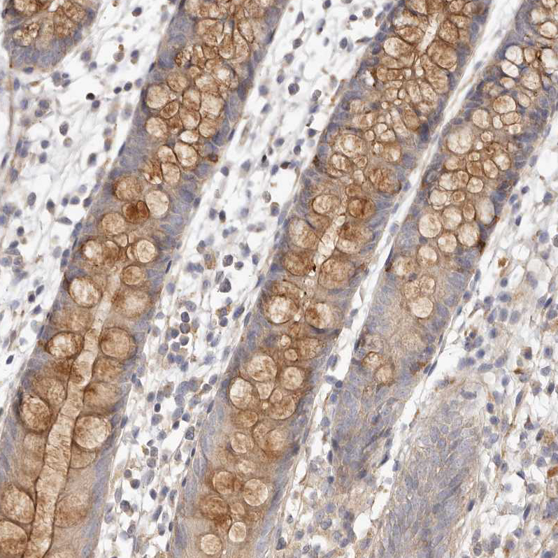 Immunohistochemistry (Formalin/PFA-fixed paraffin-embedded sections) - Anti-ADAMTS9 antibody (AB224132), expandable thumbnail