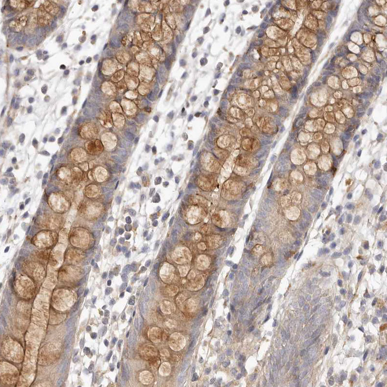 Immunohistochemistry (Formalin/PFA-fixed paraffin-embedded sections) - Anti-ADAMTS9 antibody (AB224132)
