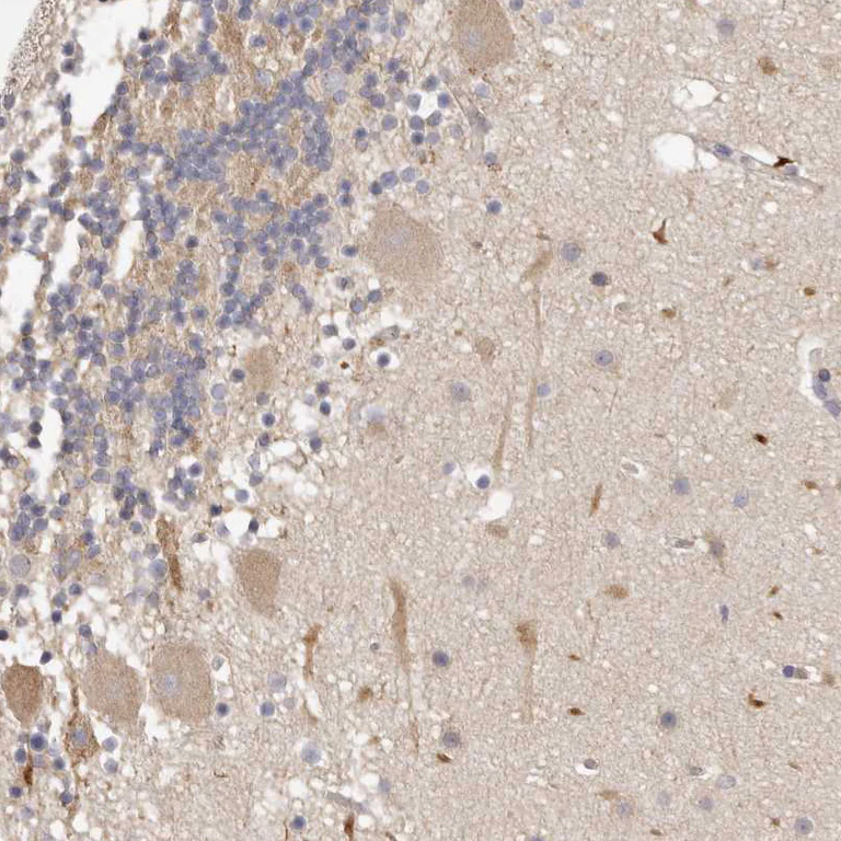 Immunohistochemistry (Formalin/PFA-fixed paraffin-embedded sections) - Anti-ADAMTS9 antibody (AB224132)