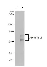 Western blot - Anti-ADAMTSL2 antibody (AB97603)