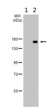 Western blot - Anti-ADAMTSL2 antibody (AB97603)