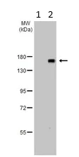 Western blot - Anti-ADAMTSL2 antibody (AB97603)