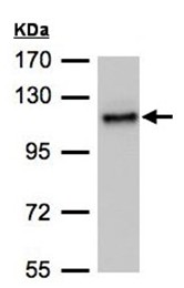 Western blot - Anti-ADAMTSL2 antibody (AB97603), expandable thumbnail