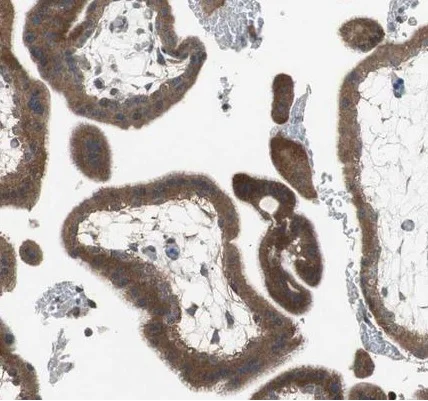 Immunohistochemistry (Formalin/PFA-fixed paraffin-embedded sections) - Anti-ADAMTSL4 antibody (AB223728)