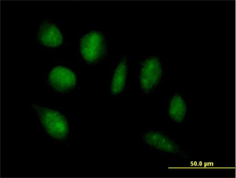 Immunocytochemistry/ Immunofluorescence - Anti-ADAMTSL4 antibody (AB71838)