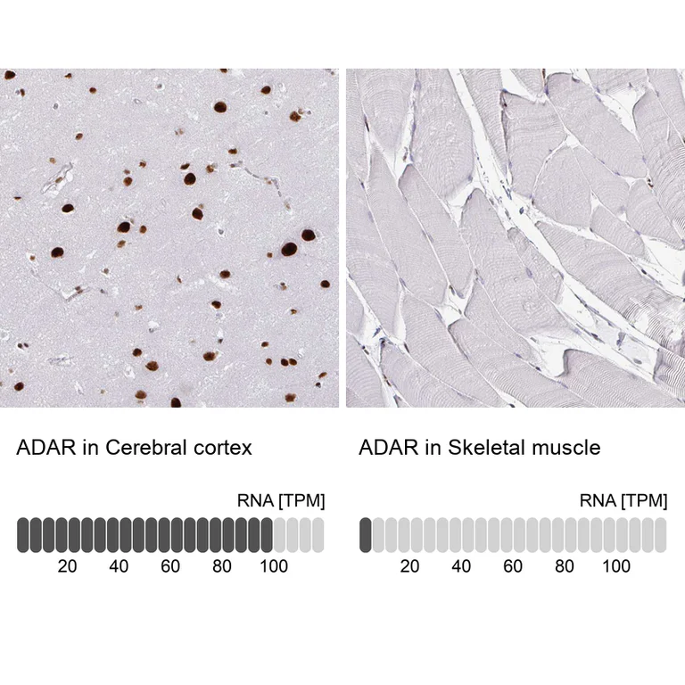 Immunohistochemistry (Formalin/PFA-fixed paraffin-embedded sections) - Anti-ADAR Antibody [CL0176] (AB327100)