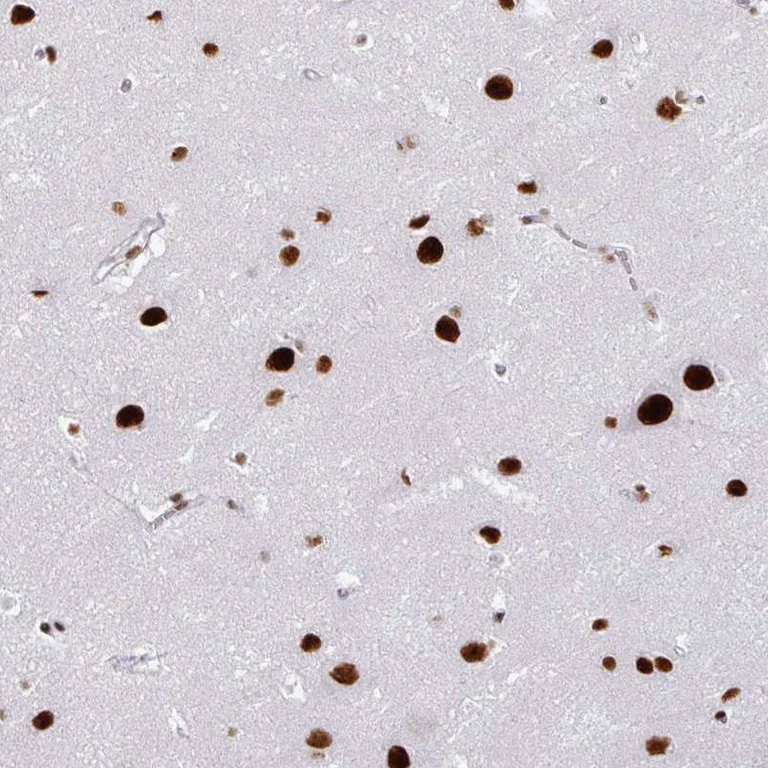 Immunohistochemistry (Formalin/PFA-fixed paraffin-embedded sections) - Anti-ADAR Antibody [CL0176] (AB327100)