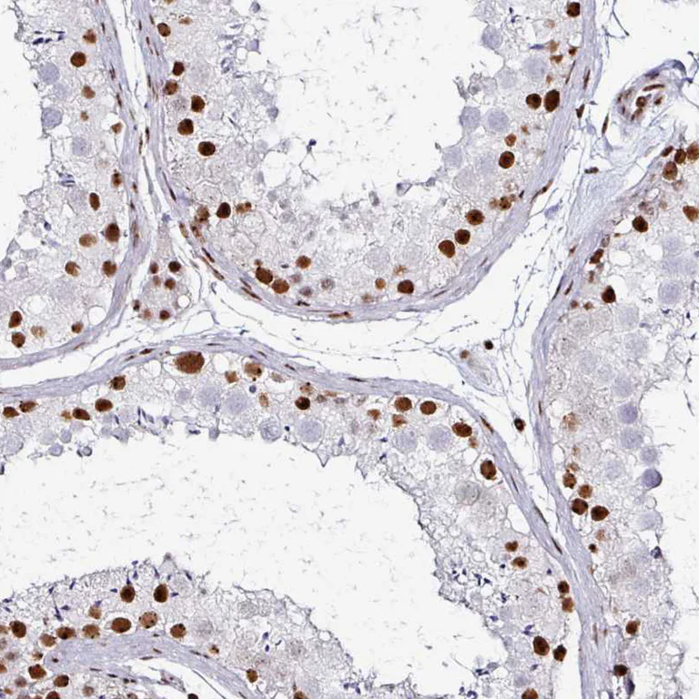 Immunohistochemistry (Formalin/PFA-fixed paraffin-embedded sections) - Anti-ADAR Antibody [CL0176] (AB327100)