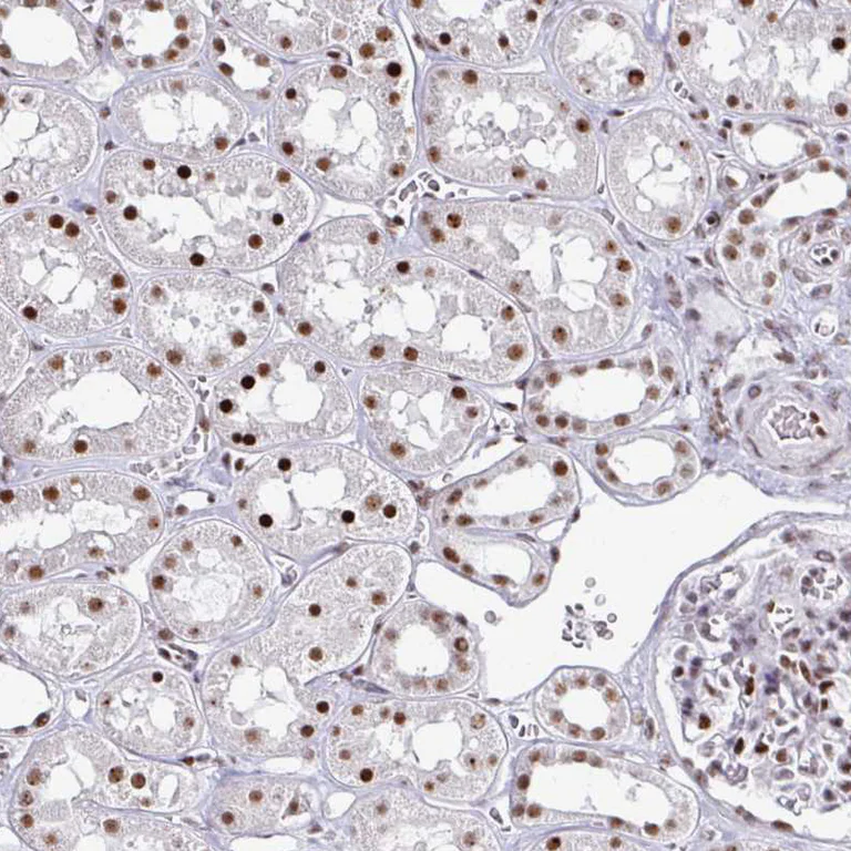 Immunohistochemistry (Formalin/PFA-fixed paraffin-embedded sections) - Anti-ADAR Antibody [CL0176] (AB327100)