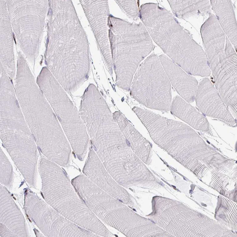 Immunohistochemistry (Formalin/PFA-fixed paraffin-embedded sections) - Anti-ADAR Antibody [CL0176] (AB327100)