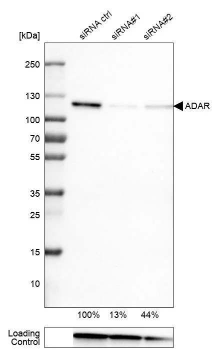 Western blot - Anti-ADAR Antibody [CL0176] (AB327100)
