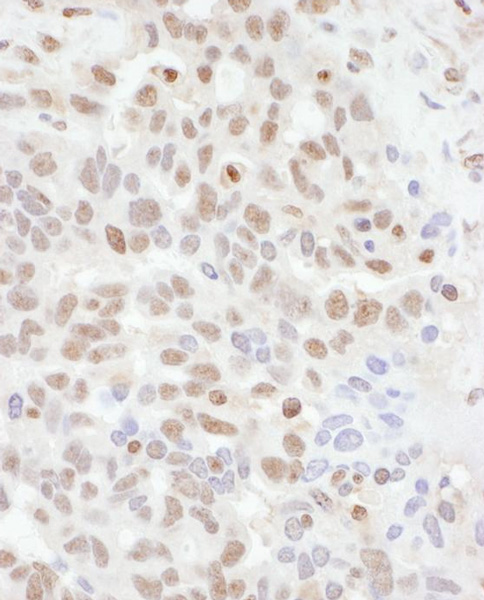 Immunohistochemistry (Formalin/PFA-fixed paraffin-embedded sections) - Anti-ADAR1 antibody (AB168809), expandable thumbnail