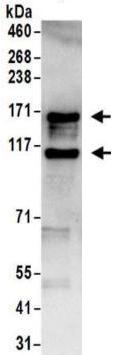 Immunoprecipitation - Anti-ADAR1 antibody (AB168809), expandable thumbnail