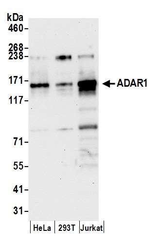 Western blot - Anti-ADAR1 antibody (AB168809), expandable thumbnail