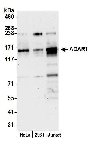 Western blot - Anti-ADAR1 antibody (AB168809)