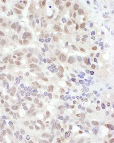 Immunohistochemistry (Formalin/PFA-fixed paraffin-embedded sections) - Anti-ADAR1 antibody (AB226188), expandable thumbnail