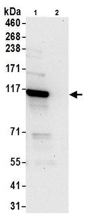 Immunoprecipitation - Anti-ADAR1 antibody (AB226188), expandable thumbnail