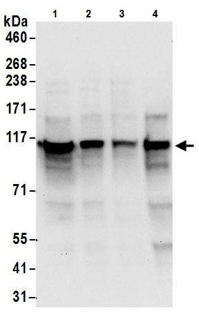 Western blot - Anti-ADAR1 antibody (AB226188), expandable thumbnail