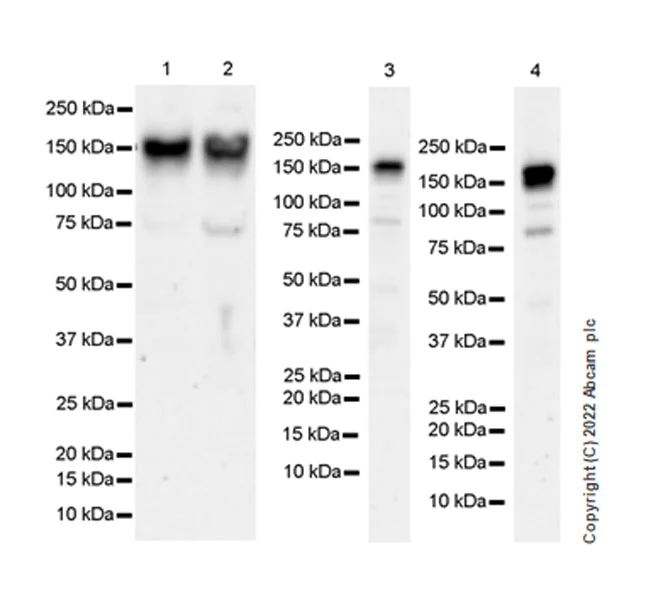 Western blot - Anti-ADAR1 antibody [EPR25431-60] (AB307585)