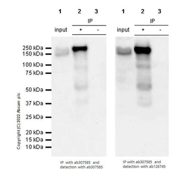 Immunoprecipitation - Anti-ADAR1 antibody [EPR25431-60] - BSA and Azide free (AB307586)