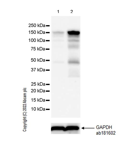 Western blot - Anti-ADAR1 antibody [EPR25431-60] - BSA and Azide free (AB307586)