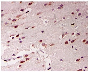 Immunohistochemistry (Formalin/PFA-fixed paraffin-embedded sections) - Anti-ADAR1 antibody [EPR7033] (AB126745), expandable thumbnail