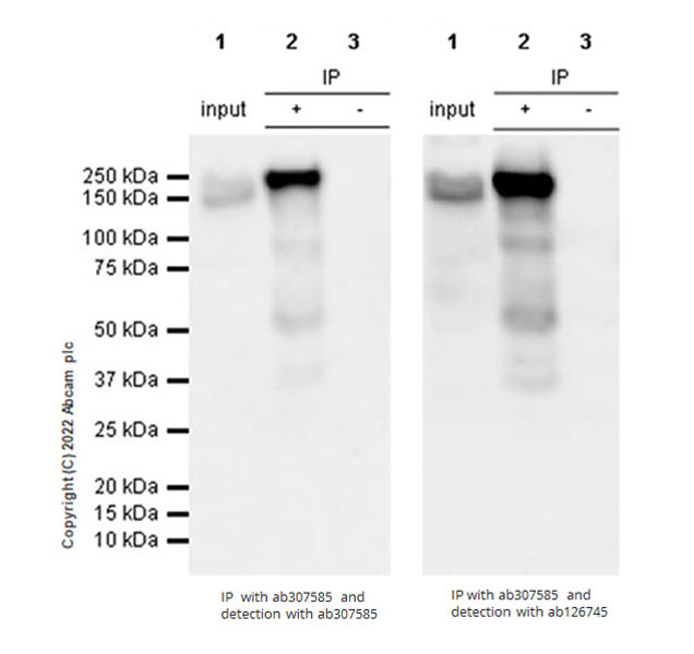 Immunoprecipitation - Anti-ADAR1 antibody [EPR7033] (ab126745), expandable thumbnail