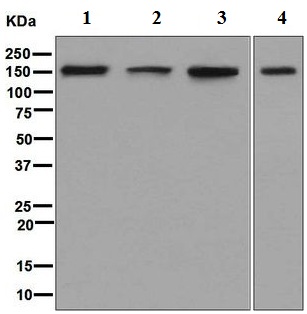 Western blot - Anti-ADAR1 antibody [EPR7033] (AB126745), expandable thumbnail