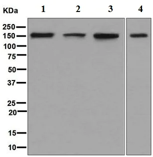 Western blot - Anti-ADAR1 antibody [EPR7033] (AB126745)