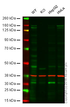 Western blot - Anti-ADAR1 antibody [EPR7033] (AB126745), expandable thumbnail