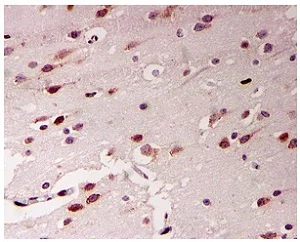 Immunohistochemistry (Formalin/PFA-fixed paraffin-embedded sections) - Anti-ADAR1 antibody [EPR7033] - BSA and Azide free (AB240029)