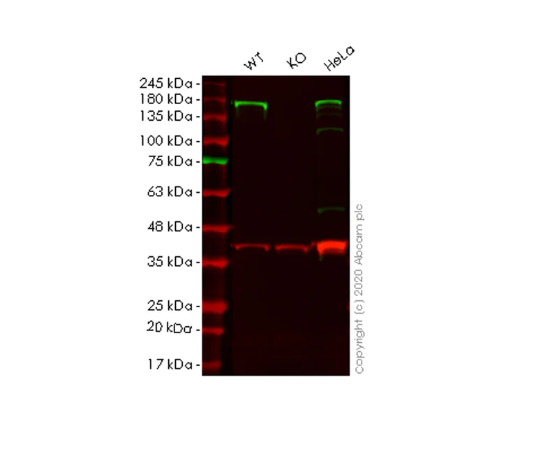 Western blot - Anti-ADAR1 antibody [EPR7033] - BSA and Azide free (AB240029)