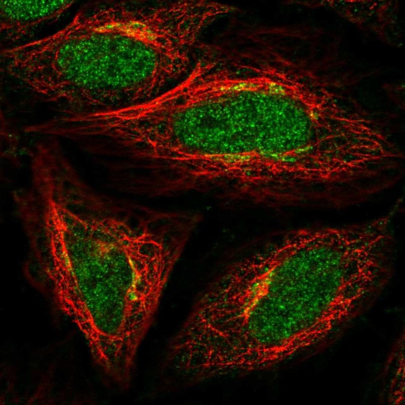 Immunocytochemistry/ Immunofluorescence - Anti-ADAT1 antibody (AB122662), expandable thumbnail
