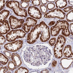 Immunohistochemistry (Formalin/PFA-fixed paraffin-embedded sections) - Anti-ADAT1 antibody (AB122662), expandable thumbnail