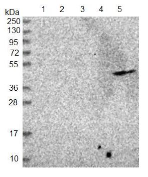 Western blot - Anti-ADAT1 antibody (AB122662), expandable thumbnail