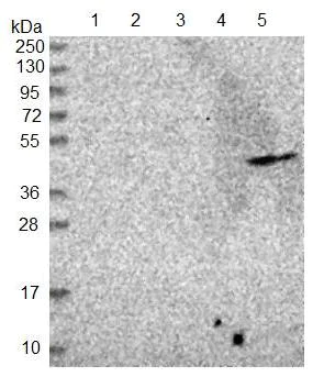 Western blot - Anti-ADAT1 antibody (AB122662)