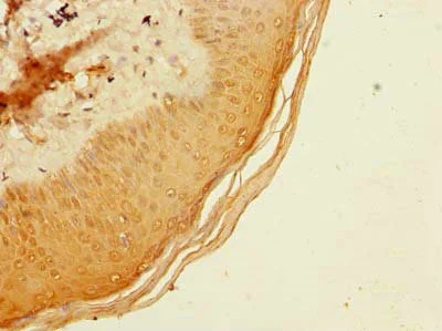 Immunohistochemistry (Formalin/PFA-fixed paraffin-embedded sections) - Anti-ADAT1 antibody (AB235341)