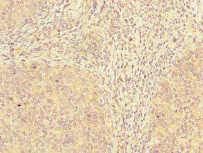Immunohistochemistry (Formalin/PFA-fixed paraffin-embedded sections) - Anti-ADAT1 antibody (AB235341)